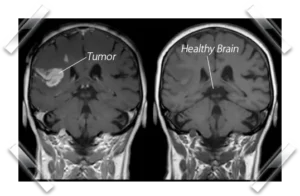 Meridian Health Protocol Benefits